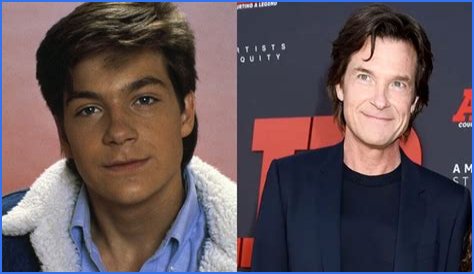 Jason Bateman Plastic Surgery Before and After